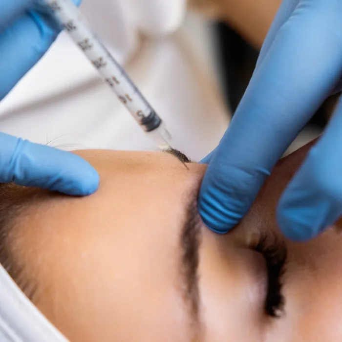 Close-up Botox injection near glabella at Avinity Health