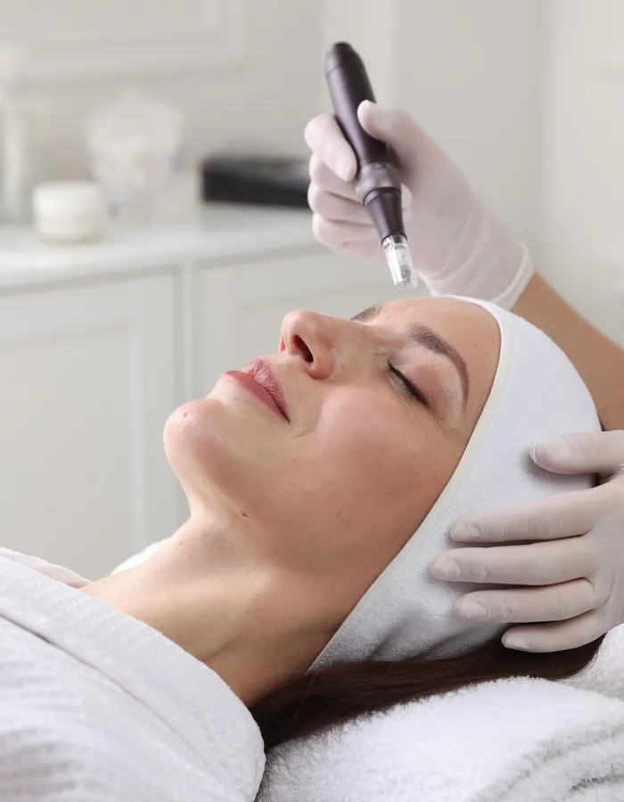 Exosome delivery during microneedling treatment at Avinity Health