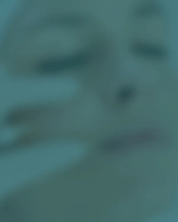 Treatment areas for dermal fillers at Avinity Health