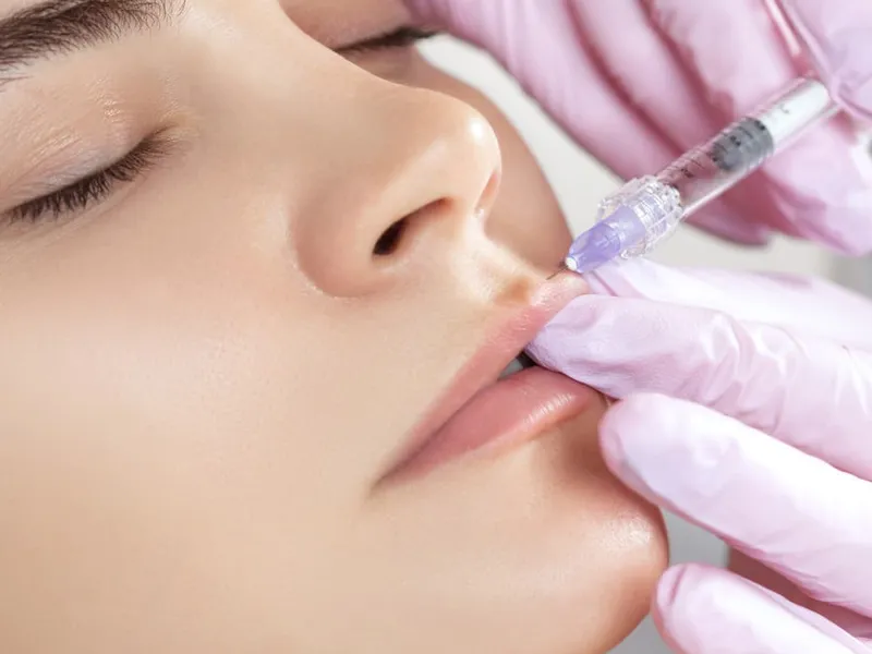 Dermal filler treatment at Avinity Health Scottsdale