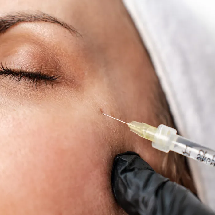 Botox injection near cheek by gloved practitioner at Avinity Health