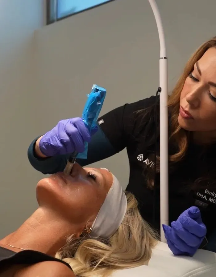 Registered nurse performing medical-grade microneedling treatment at Avinity Health Scottsdale