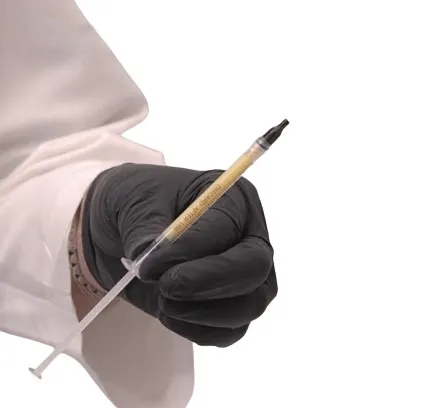 A gloved hand holding a syringe of prepared golden plasma gel ready for placement at Avinity Health Scottsdale