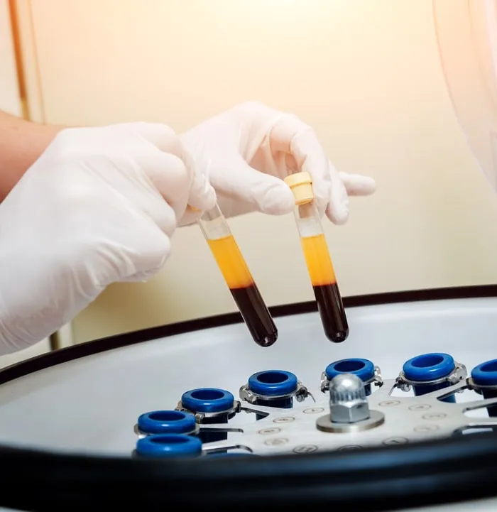 Gloved hands loading blood tubes into the centrifuge to separate plasma for Selphyller plasma gel at Avinity Health Scottsdale