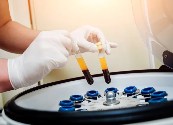 Gloved hands loading blood tubes into the centrifuge to separate plasma at Avinity Health Scottsdale
