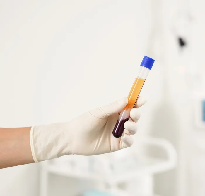 A gloved hand holding a spun blood tube, the golden platelet-rich plasma separated above the red cells, at Avinity Health Scottsdale