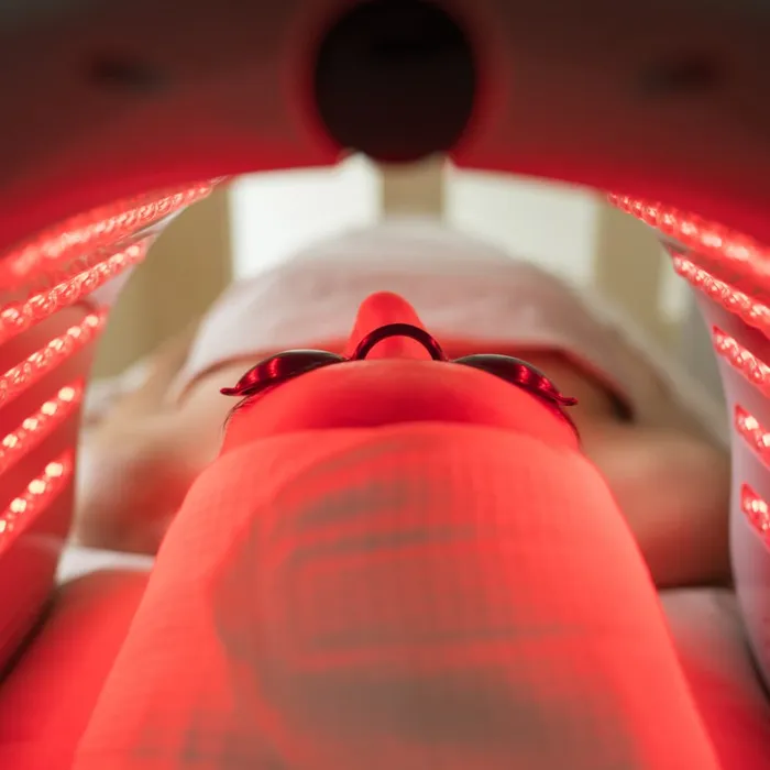 A patient under a red light therapy panel with protective eye shields, used alongside microneedling at Avinity Health