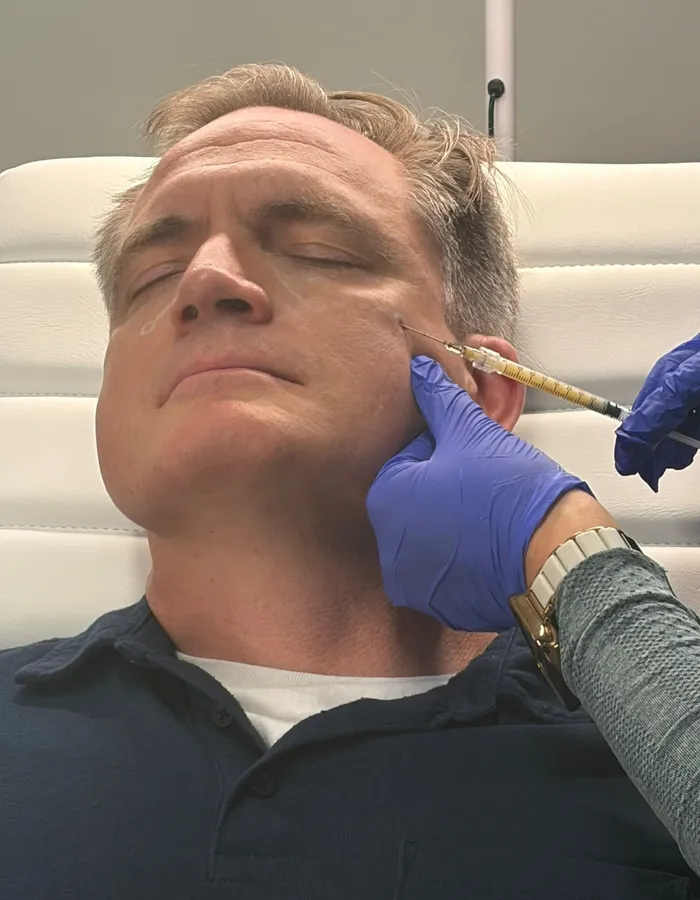 Selphyller plasma gel being injected into the cheek by an Avinity Health injector in Scottsdale
