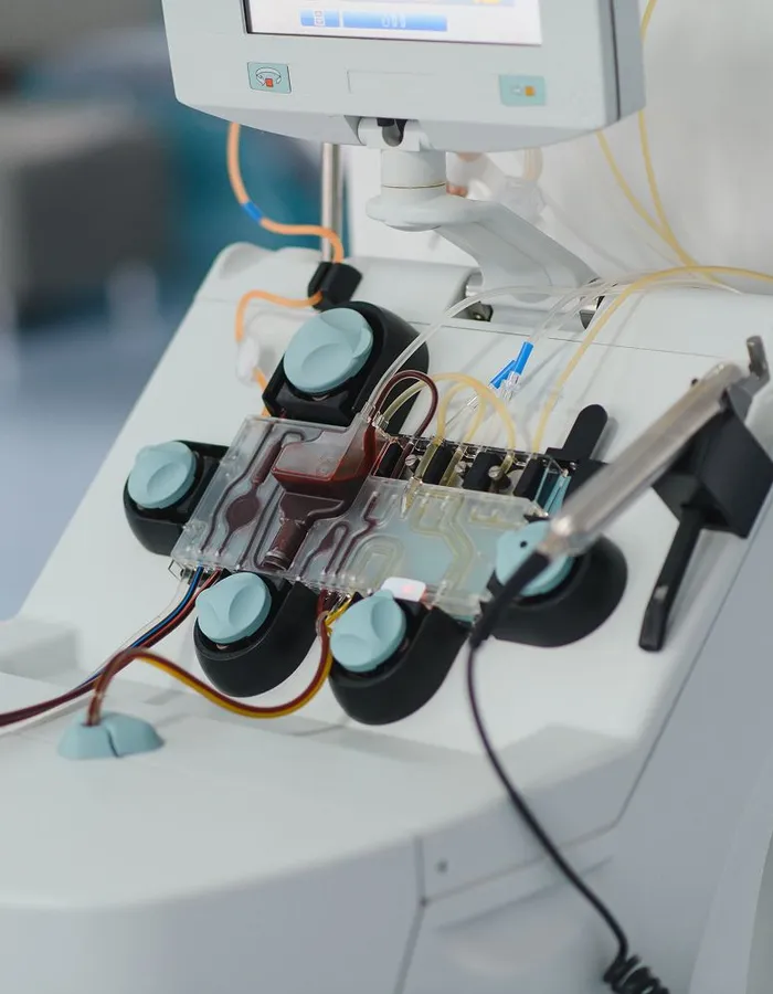 Therapeutic plasma exchange procedure at Avinity Health