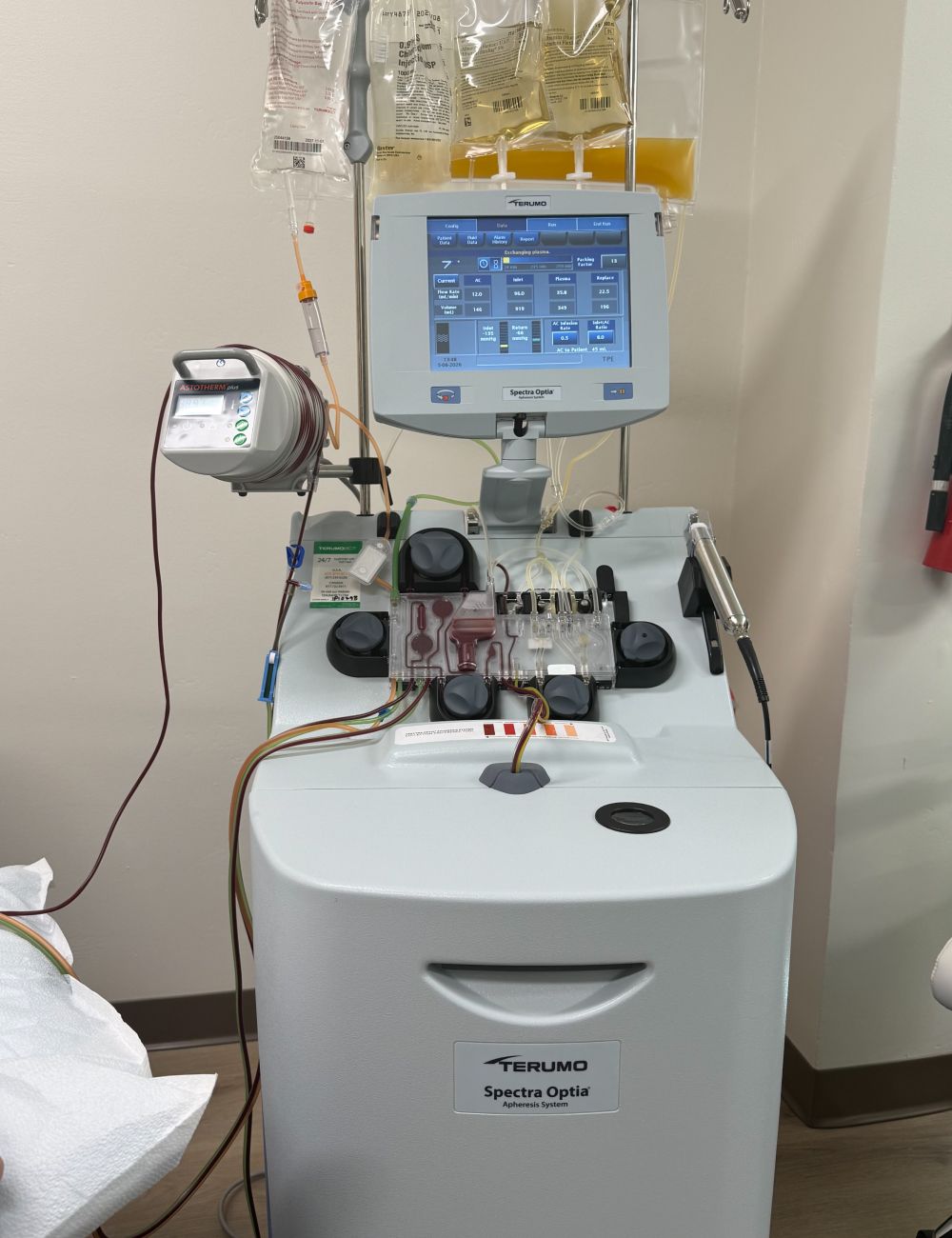 Therapeutic plasma exchange machine at Avinity Health