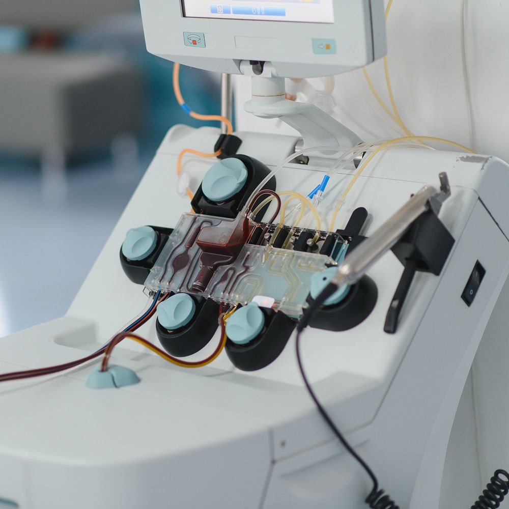 Therapeutic plasma exchange procedure at Avinity Health