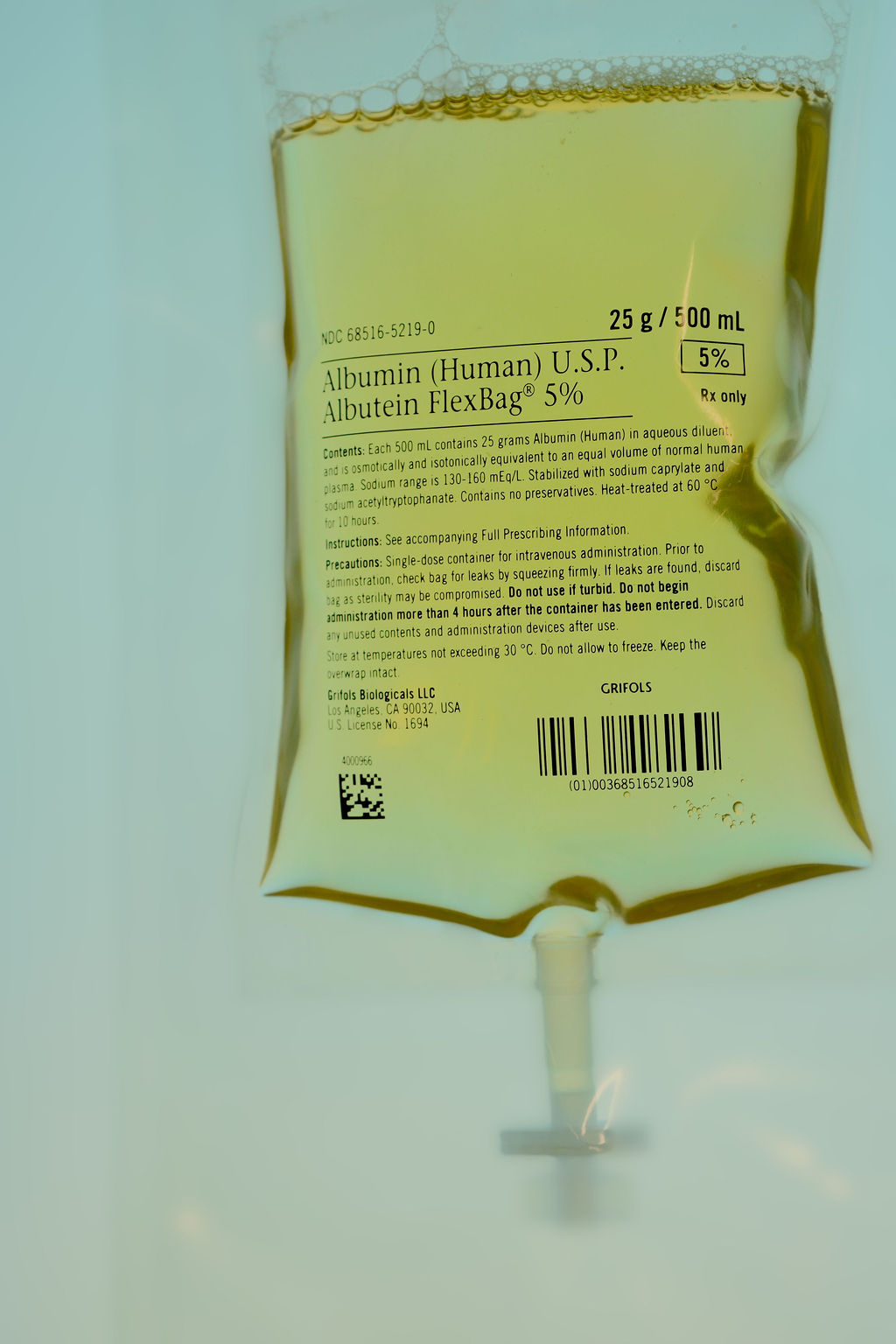 Albumin bag used in therapeutic plasma exchange at Avinity Health