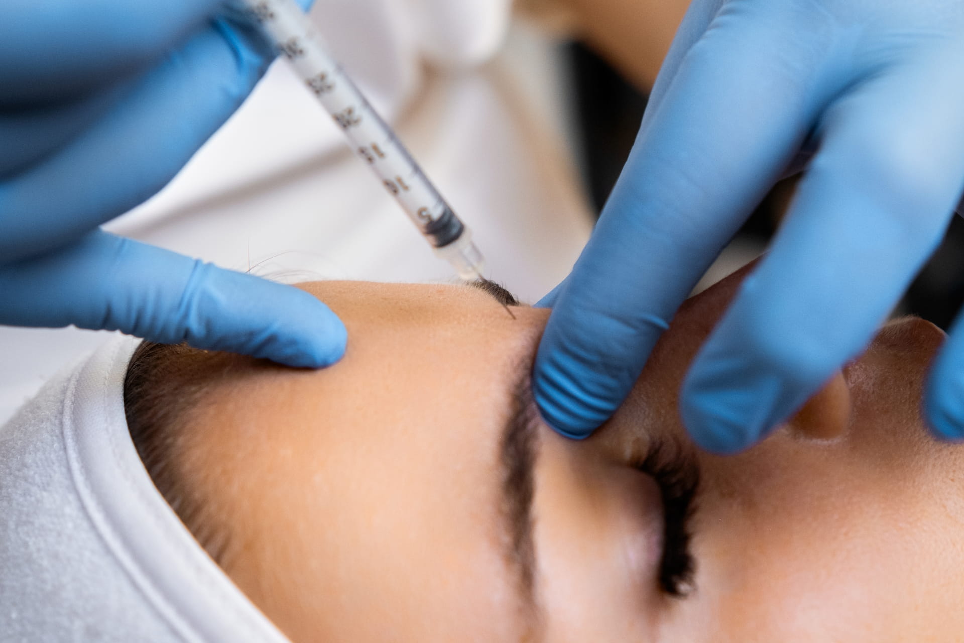 Close-up Botox injection near glabella at Avinity Health