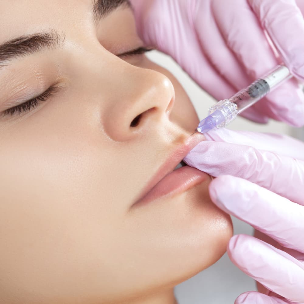 Dermal filler treatment at Avinity Health Scottsdale