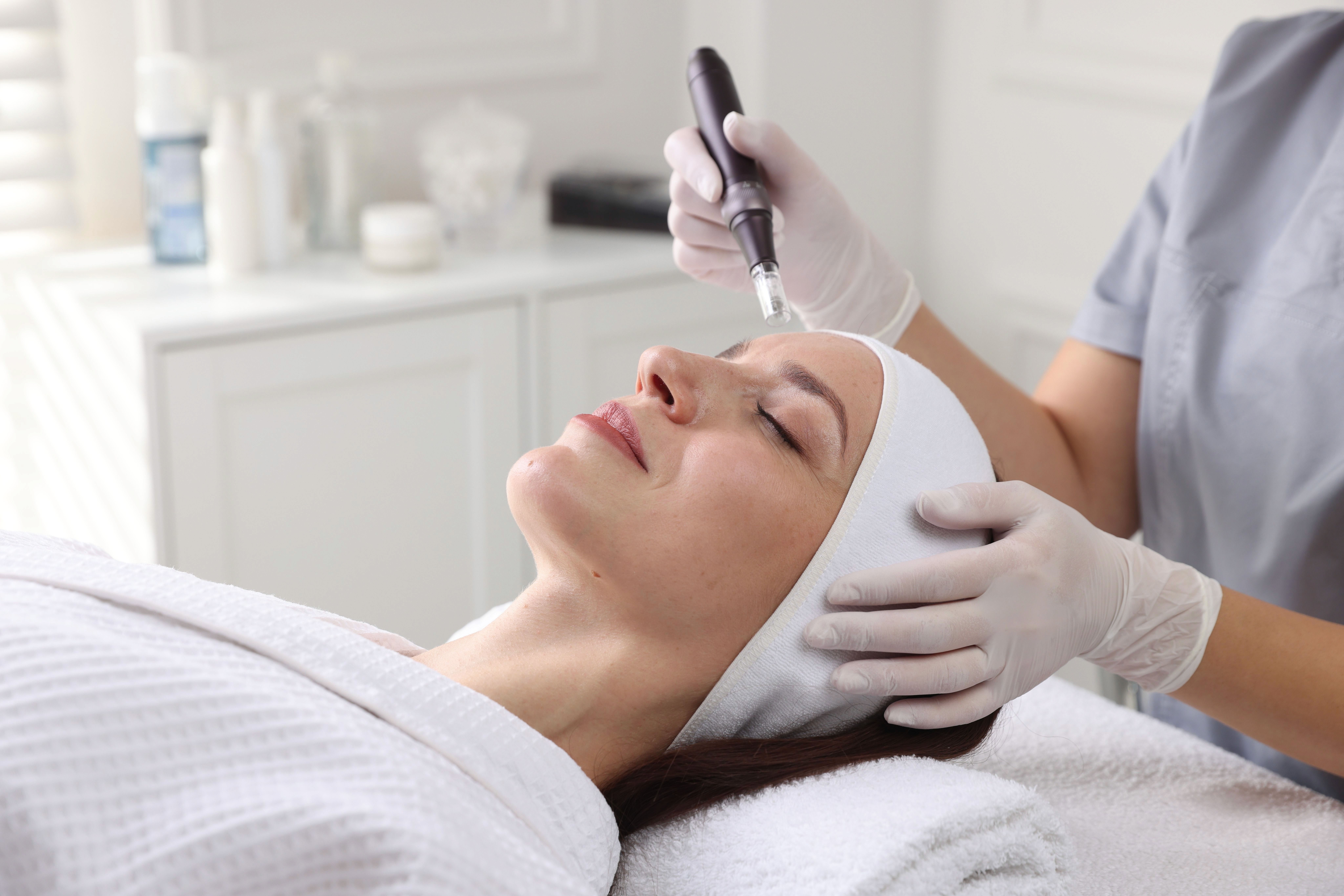 Exosome delivery during microneedling treatment at Avinity Health